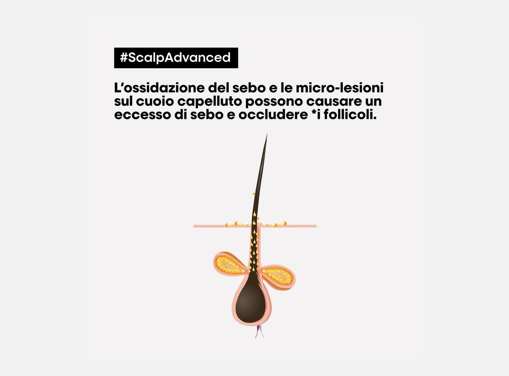 L'Oreal Shampoo Cute Grassa Scalp Advance Serie Expert 300ML